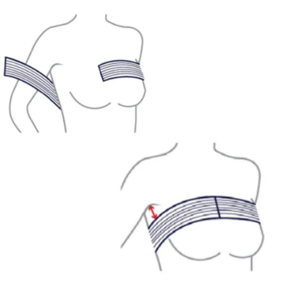 Banda Postoperatoria Mamoplastia de Aumento - Compresión Óptima - Image 3